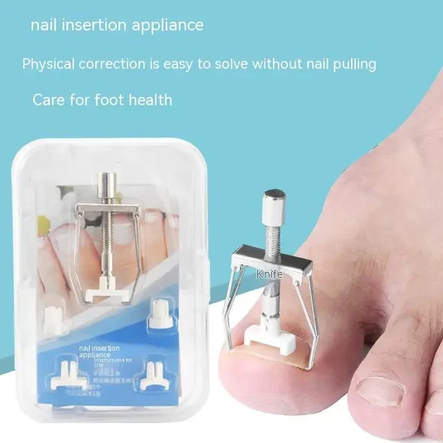 INGROWN TOENAIL #A